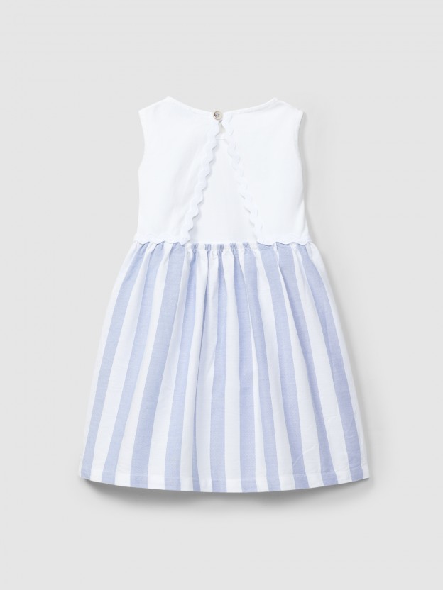 Open-back striped dress Open-back striped dress